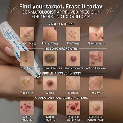 💜⭐𝖧𝖨𝖲𝖪𝖨𝖭®👩‍⚕️⭐ 𝟕-𝐃𝒂𝘆 𝐒𝗸𝐢𝐧 𝐓𝒂𝗴 & 𝐒𝐩𝙤𝐭 𝐄𝐫𝒂𝐬𝙚𝐫 Painless & Scar-Free Advanced Imperfection Removal Rollerball Pen